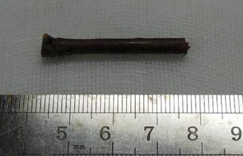 “小小竹棍把我害的好苦啊!幸好，遇到了厦门眼科中心眼整形科的胡继发副主任。医术好、态度好。大医院 医生就是不一样!”——医治眼睛后的老李激动的说道2.jpg