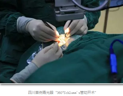 成都8868在线官网登录平台 - 8868网页版登录已经开展的青光眼手术有：引流阀 (钉)植入手术(2015年以来已200多 )，360°Schlemm's管切开术，激光CO2 辅助巩膜深层切除术，小梁切除术青(光眼)白(内障)联合手术。还有虹膜周切术、前房成形术、 虹膜复位术，睫状体冷冻术，小梁切开术和前房穿刺术等6.png
