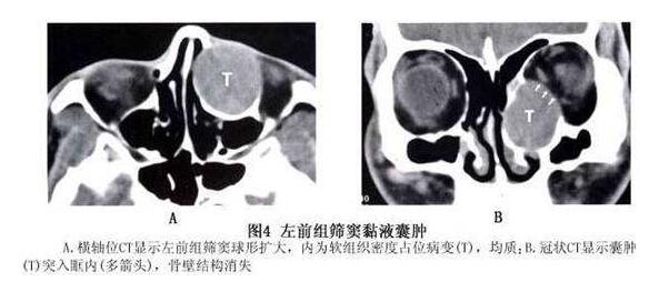 4月7-8日，天津医科大学眼科医院副院长、天津医科大学眼视光学院副院长、中华眼科学会委员、眼整形、眼眶病学组副组长孙丰源教授将莅临福州眼科医院2.jpg