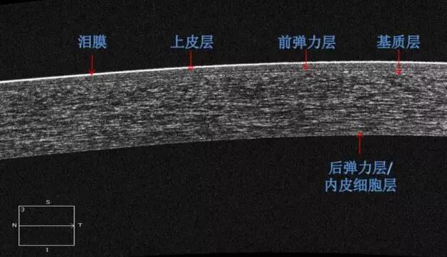 8868登录平台课堂：后节频域OCT前节模块的运用2.jpg