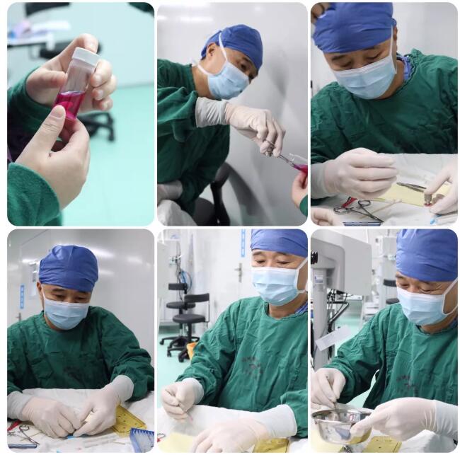 姚晓明教授来福州眼科医院，为解除角膜病患痛苦3.jpg