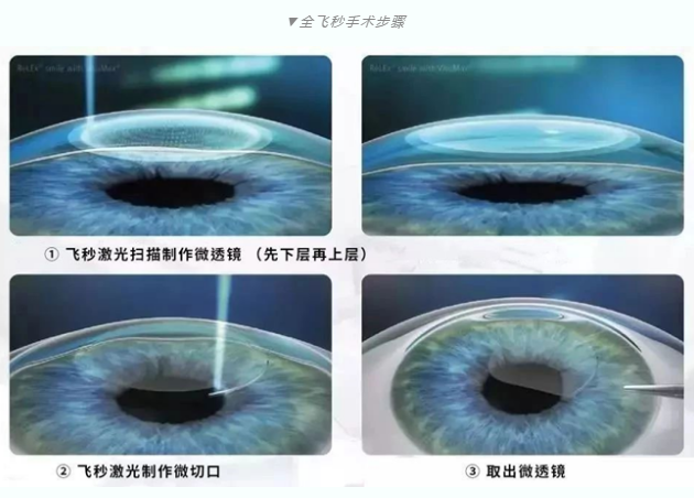 7月26日来深圳8868在线官网登录平台 - 8868网页版登录参与暑期摘镜季活动就可以有机会参与抽奖免单手术！2.png