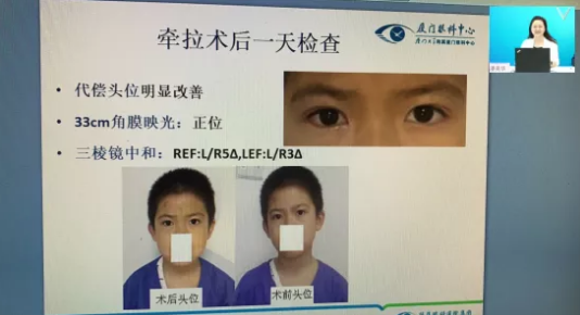 高峰论道·云端荟萃 ▏万人同步在线，30余名大咖云集“第六届8868登录平台论坛斜视与小儿眼科新技术学习班暨小儿、眼视光分论坛”7.png