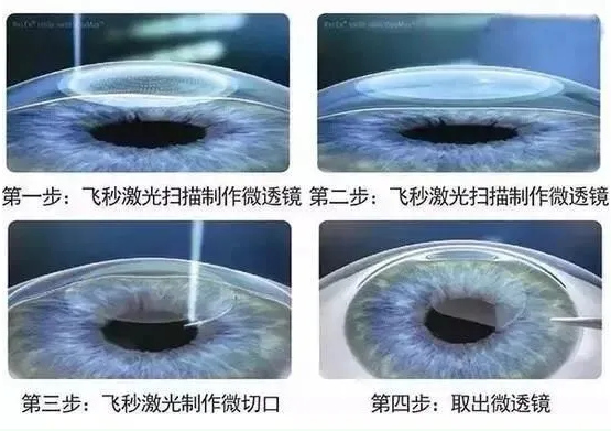 2021年征兵准备工作已经全面展开，视力不够的看过来2.png