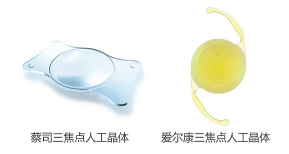 我看到了9个月亮，中国医生一招解决！“洋女婿”患白内障几近失明，在厦门眼科中心手术4.png