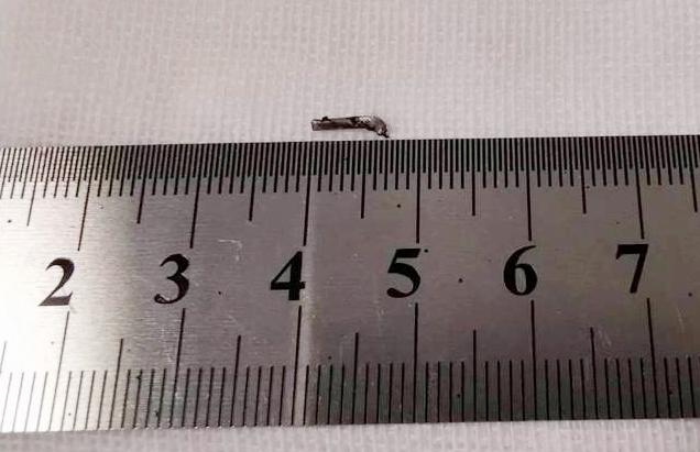 8868登录平台徐州复兴眼科王海菊：妙手拨迷障，匠心护光明3.png